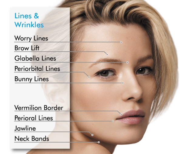 FREE Facial Rejuvenation Assessments - Brucegate Dental ... botox dental diagram 